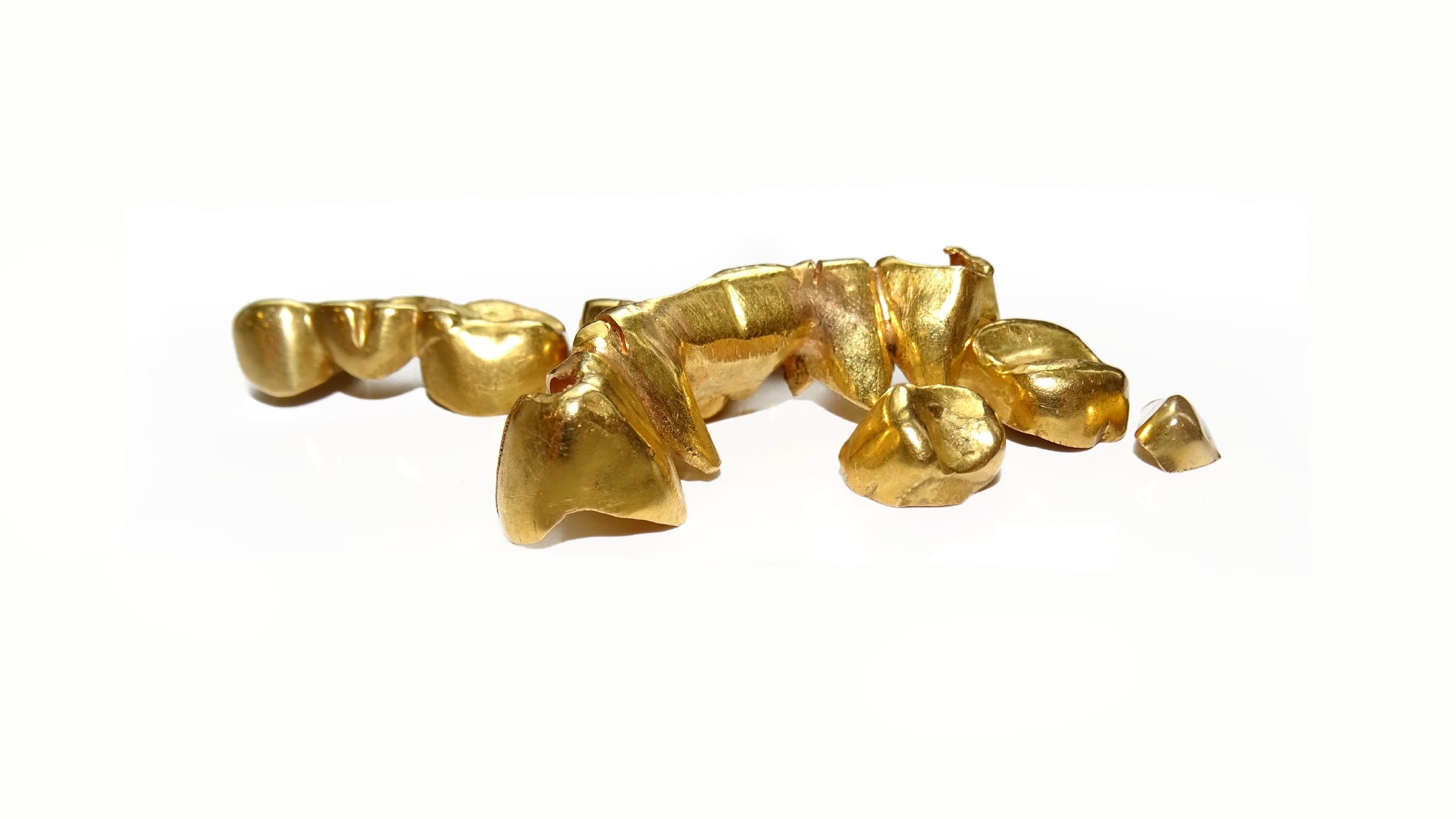 zahngold-ankauf-berlin-titelbild